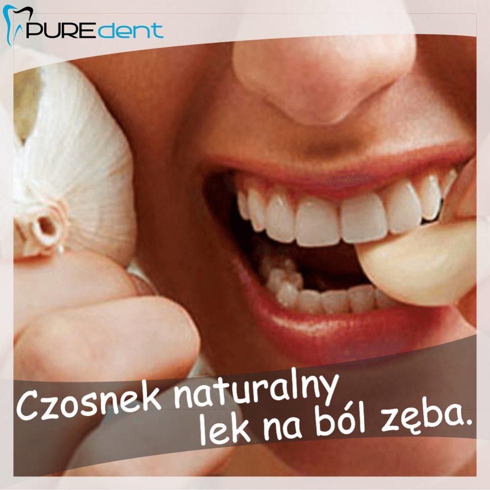 Czosnek Naturalny Lek Na Ból Zęba Puredent Stomatologia Estetyczna I Ortodoncja Dentysta 3345