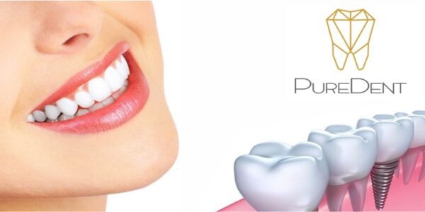 Konsultacja Implantologiczna + Tomografia 299 zł